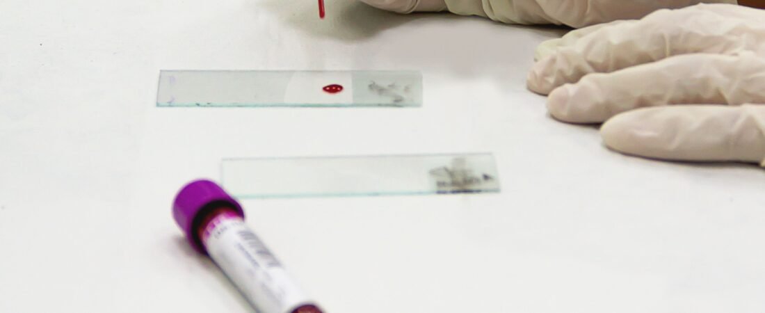 What Is HIV? Common Myths and Facts Everyone Should Know