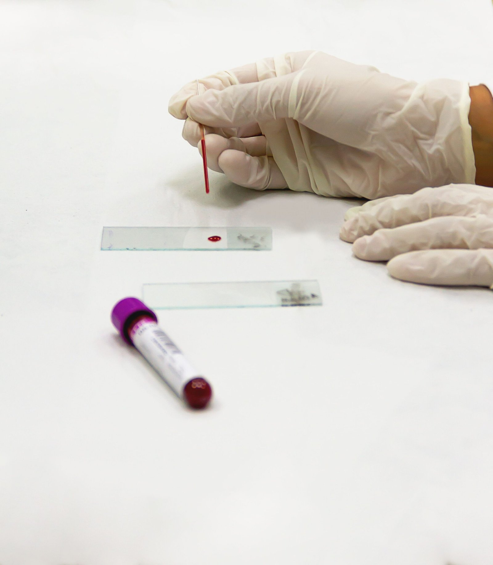 What Is HIV? Common Myths and Facts Everyone Should Know
